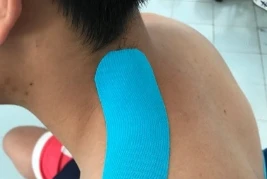 ĐAU CỔ