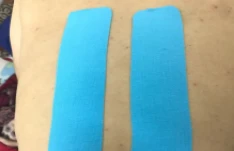 ĐAU LƯNG